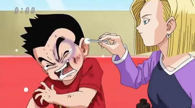 Krillin recibió un fuerte golpe de Goku en el episodio 16 de Dragon Ball Super. (Foto: Toei Animation / Akira Toriyama)